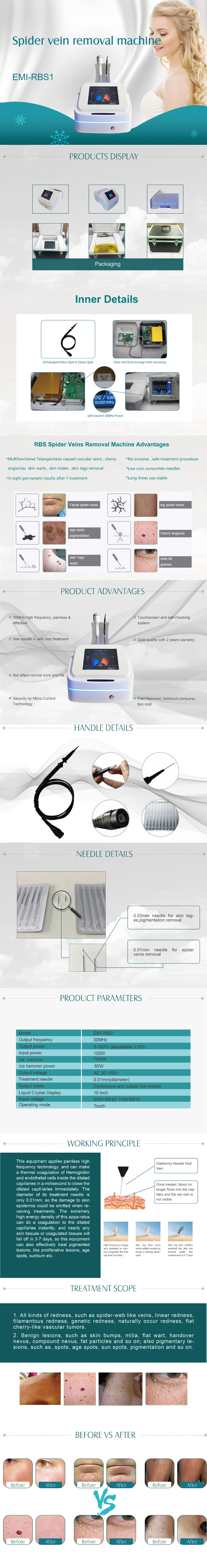 High frequency spider vein removal device RBS1